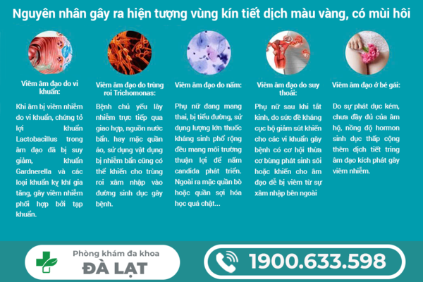 Hình ảnh minh họa